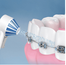 Irrigateur buccal et soins orthodontiques